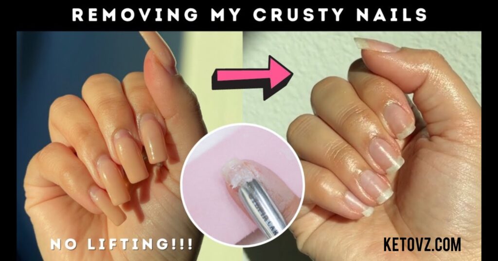 how to remove gel x nails